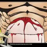 Baccus_-_Another_Procedure0042