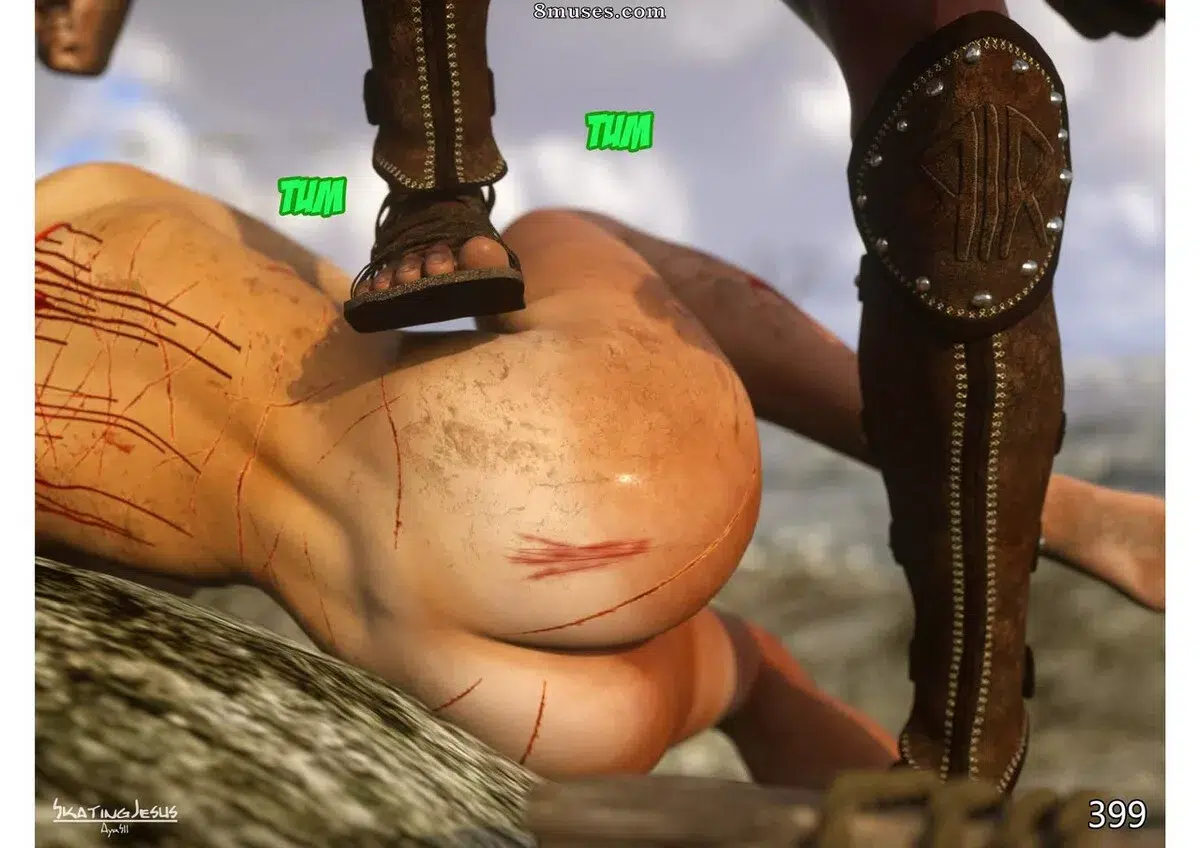 399